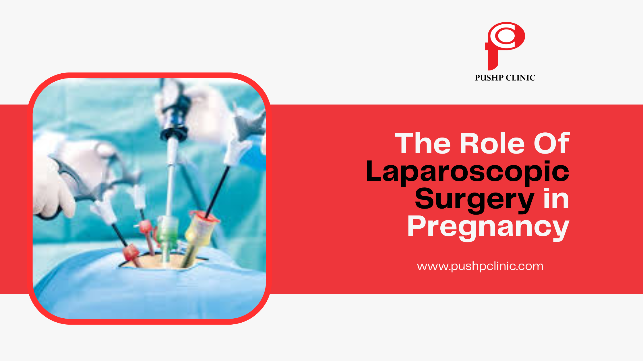 best Laparoscopic Surgeon in Indore