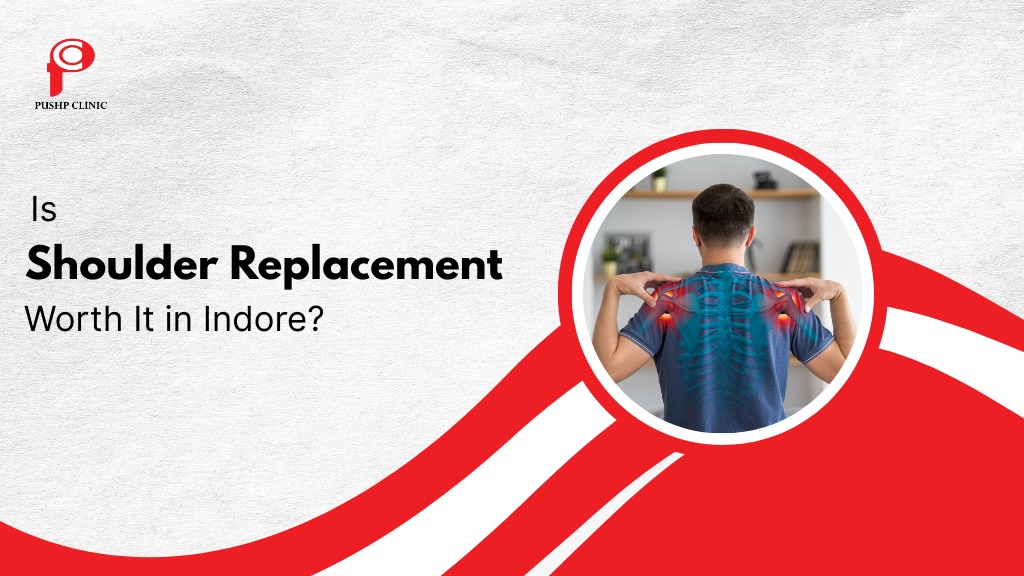 Is Shoulder Replacement Worth It in Indore
