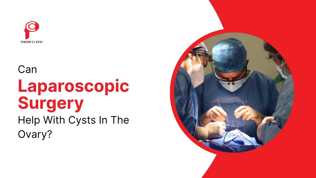 Can Laparoscopic Surgery Help With Cysts In The Ovary?